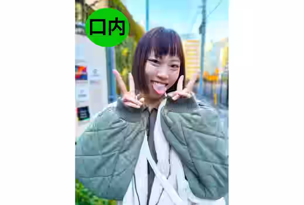 街角で声をかけて口内観察させてもらう　オーガニックスーパー勤務　はつみちゃん（ATLNKO03-3）【街角口内】