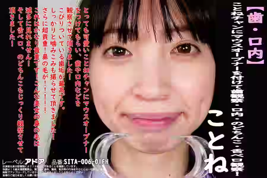 【口&歯】【歯・口内】大人気美女ことねチャンのマウスオープナーを付けて歯観察・口内・のどちんこ・舌ベロ観察!ことね【アドア】